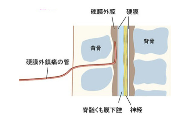 図2