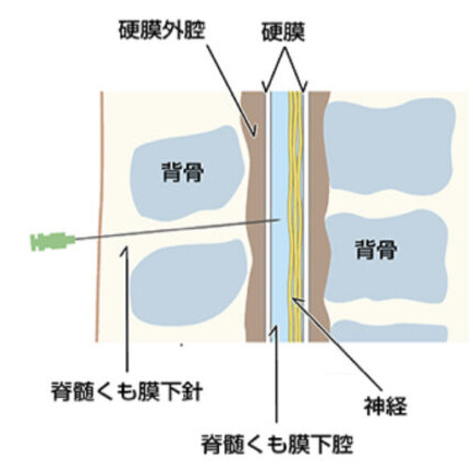 図3